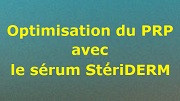 Image PRP boosté avec sérum StériDERM